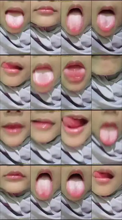 jilbab melet (1)